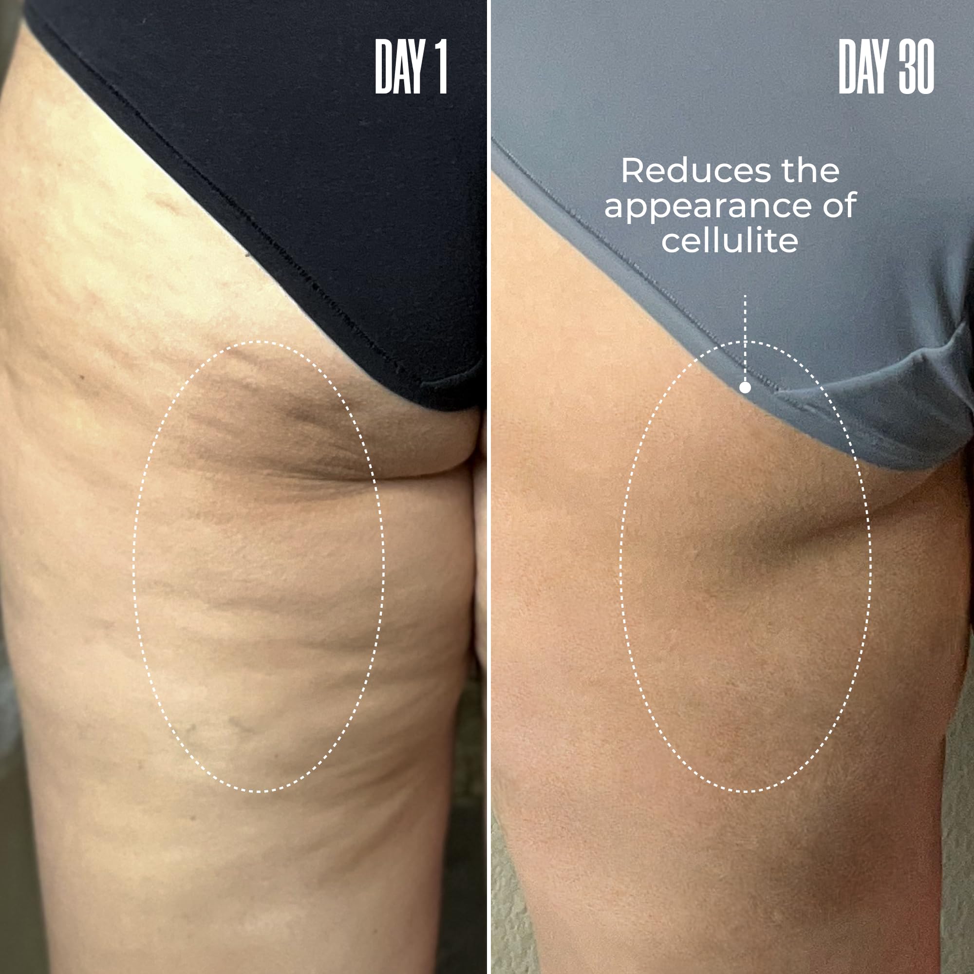 MAËLYS Cosmetics B-TIGHT Leave-On Cellulite Mask - Reduces The Appearance Of Cellulite - Visibly Tightens The Skin In The Butt Area