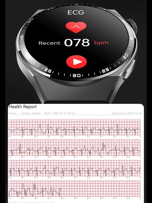 AD VISION Smart Fitness Watches, Sports Watch & Fitness Trackers, 1.55” HD Touchscreen, 24/7 Health Monitoring with ECG, Blood Oxygen & Sleep Tracking, 150+ Sports Modes, IP67, for Men & WomenAD VISION